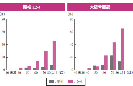 (�})���e頏ǂ̔N��ʗL�a��